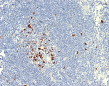 Topoisomerase II alpha Antibody / TOP2A