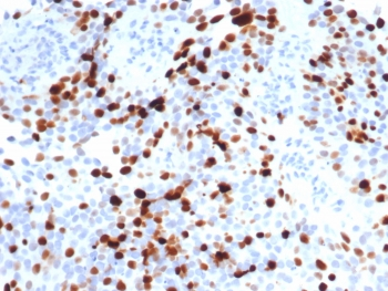 Topo IIa Antibody / Topoisomerase II alpha