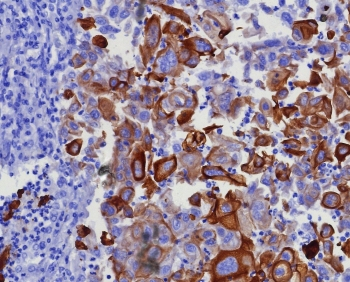 KRT17 Antibody / Cytokeratin 17