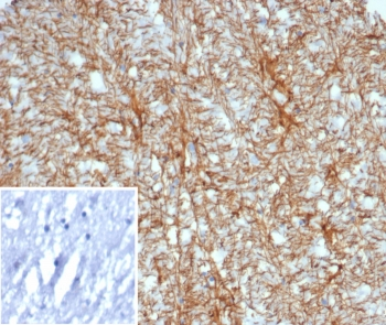 GFAP Antibody / Glial Fibrillary Acidic Protein