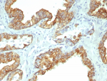 Recombinant CK19 Antibody / Cytokeratin 19