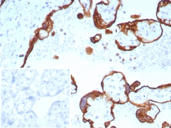 Acidic Cytokeratin Antibody (LMW / Type I)