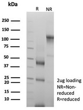Acidic Cytokeratin Antibody (LMW / Type I)