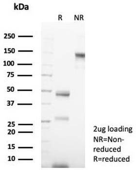 Cytokeratin 14 Antibody / CK14 / KRT14