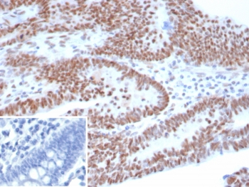p53 Antibody / TP53