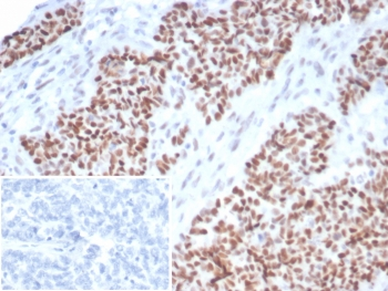 p53 Antibody / TP53
