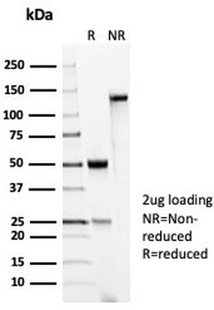 p53 Antibody / TP53
