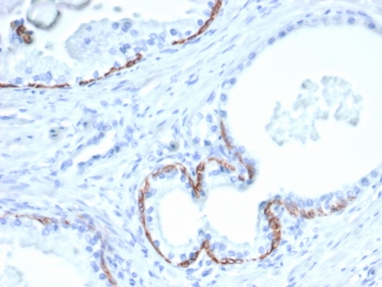 KRT10 Antibody / Cytokeratin 10
