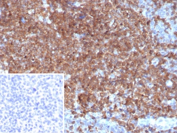 CSF3 Antibody / Granulocyte-Colony Stimulating Factor