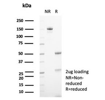CSF3 Antibody / Granulocyte-Colony Stimulating Factor