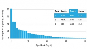 CSF3 Antibody / Granulocyte-Colony Stimulating Factor