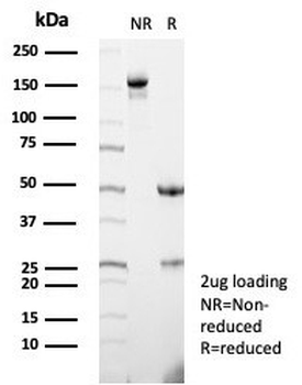 CSF3 Antibody / Granulocyte-Colony Stimulating Factor