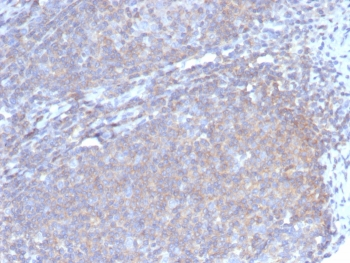 CSF3 Antibody / Granulocyte-Colony Stimulating Factor