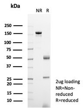 CSF3 Antibody / Granulocyte-Colony Stimulating Factor
