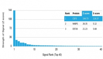 CSF3 Antibody / Granulocyte-Colony Stimulating Factor