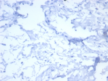 HER2 Antibody / ErbB2