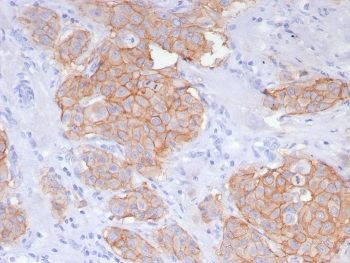 HER2 Antibody / ErbB2