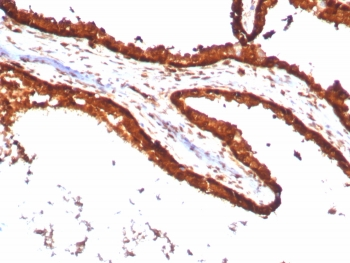 Recombinant 14-3-3E Antibody / YWHAE