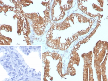 Recombinant YWHAE Antibody / 14-3-3E