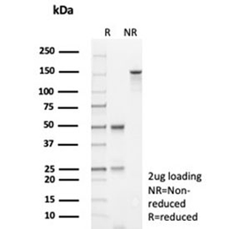 p53 Antibody / TP53