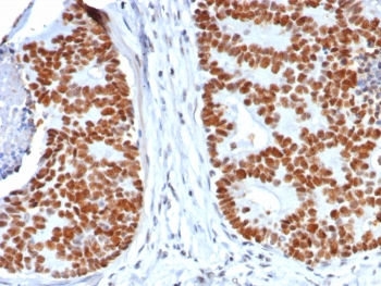 p53 Antibody / TP53