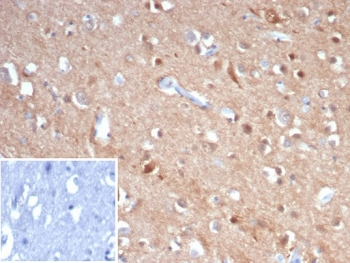 Beta Tubulin Antibody / TUBB3