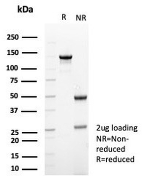 Beta Tubulin Antibody / TUBB3