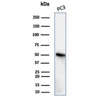 Beta Tubulin Antibody / TUBB3