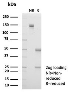Haptoglobin Antibody