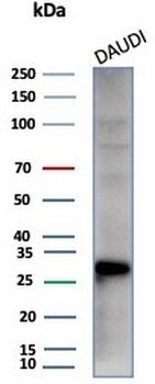 Haptoglobin Antibody
