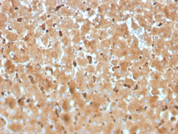 Haptoglobin Antibody