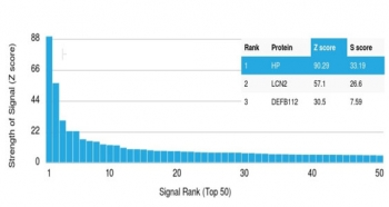 Haptoglobin Antibody