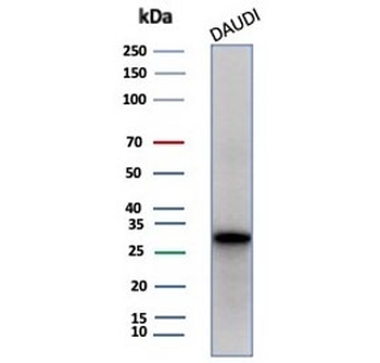 Haptoglobin Antibody