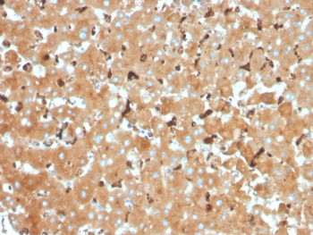 Haptoglobin Antibody