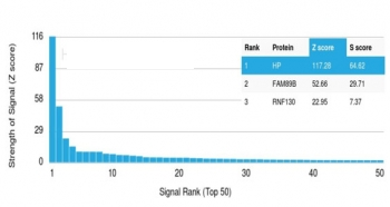 Haptoglobin Antibody
