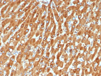 Haptoglobin Antibody