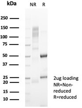Haptoglobin Antibody