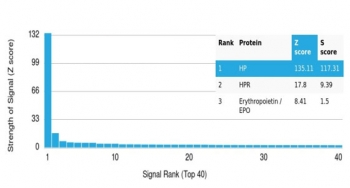 Haptoglobin Antibody