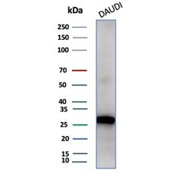 Haptoglobin Antibody