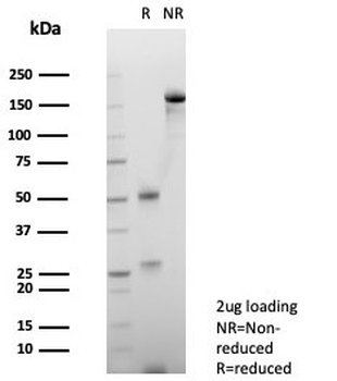 Haptoglobin Antibody