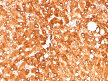 Haptoglobin Antibody