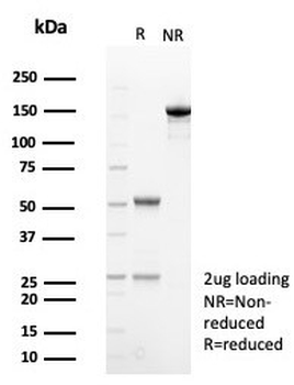 Haptoglobin Antibody