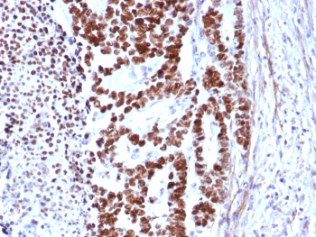 p53 Antibody / TP53