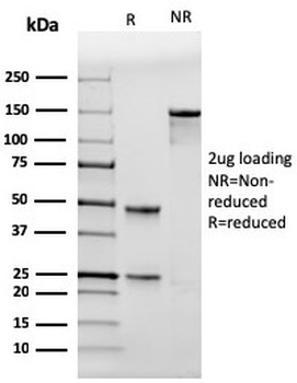 p53 Antibody / TP53