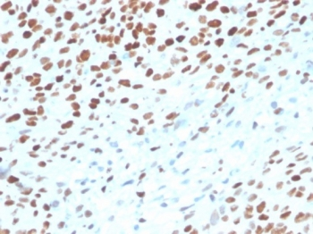 p53 Antibody / TP53
