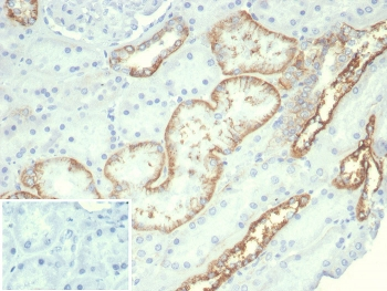 Recombinant CDH16 Antibody / Cadherin 16