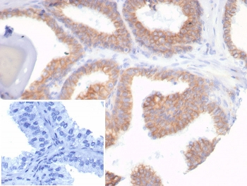 E-Cadherin Antibody / CDH1