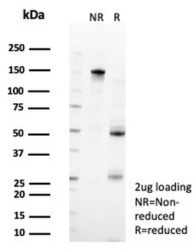 ZFP90 Antibody