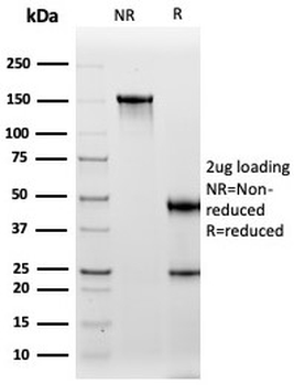 Cadherin 16 Antibody / CDH16
