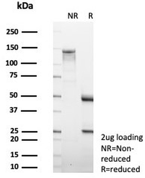 MMP2 Antibody